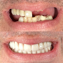 Mario Garita MP Dental Experience