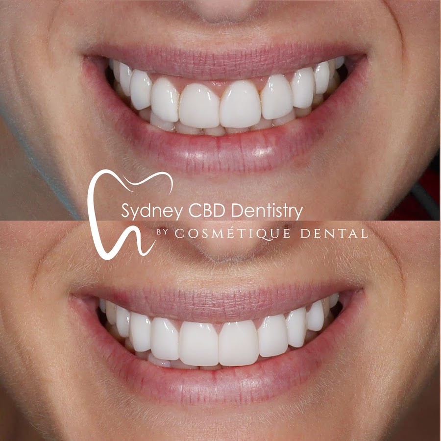 Sydney CBD Dentistry | Cosmetique Dental - dental clinic in Sydney, Australia