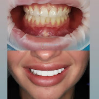 North Sydney Dentistry | Cosmetique Dental