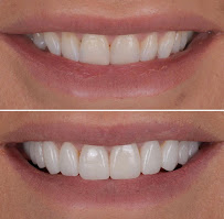 Dental Lounge Sydney CBD