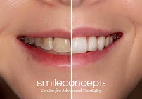 Smile Concepts