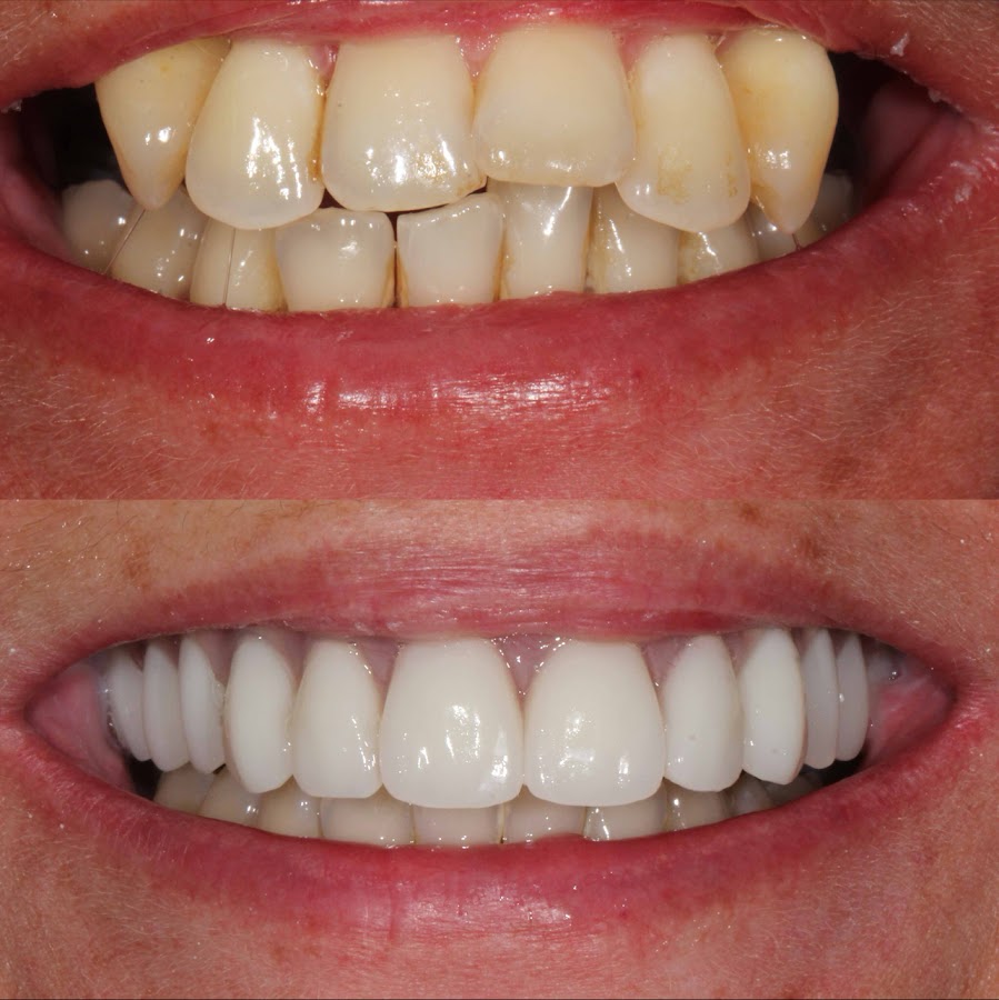 Lumiere Dental and Implants Centre - dental clinic in Sydney, Australia