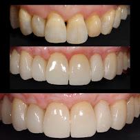 Lumiere Dental and Implants Centre