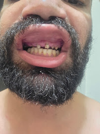Amatista l Estetica Dental Cancún