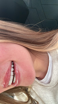 Amatista l Estetica Dental Cancún