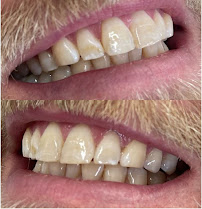 Art De Dente - Dentist Melbourne CBD