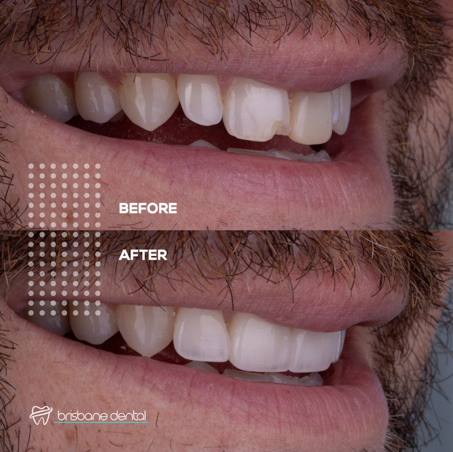 Brisbane Dental - dental clinic in Brisbane, Australia