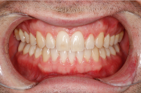 Wickham Terrace Dental