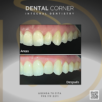 Clínica Dental Corner