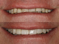 Everton Hills Dental Clinic