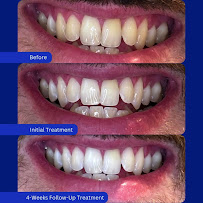 White and Bright: Teeth Whitening Studios