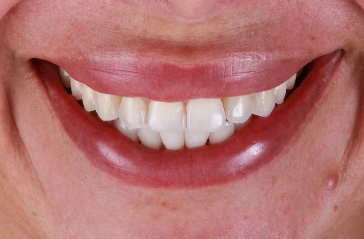 RO Dental - Dentistas en Cancún - dental clinic in Cancun, Mexico