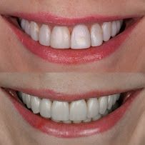 Advanced Dental Artistry