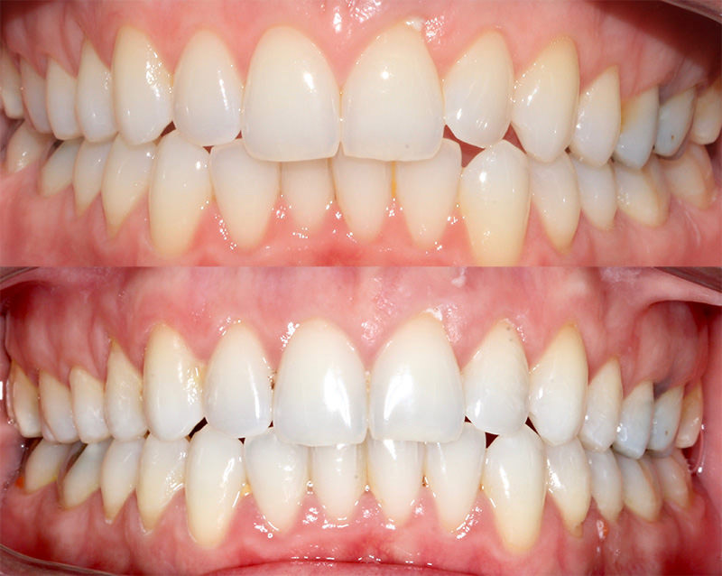 Dental Members Adelaide City - dental clinic in Adelaide, Australia