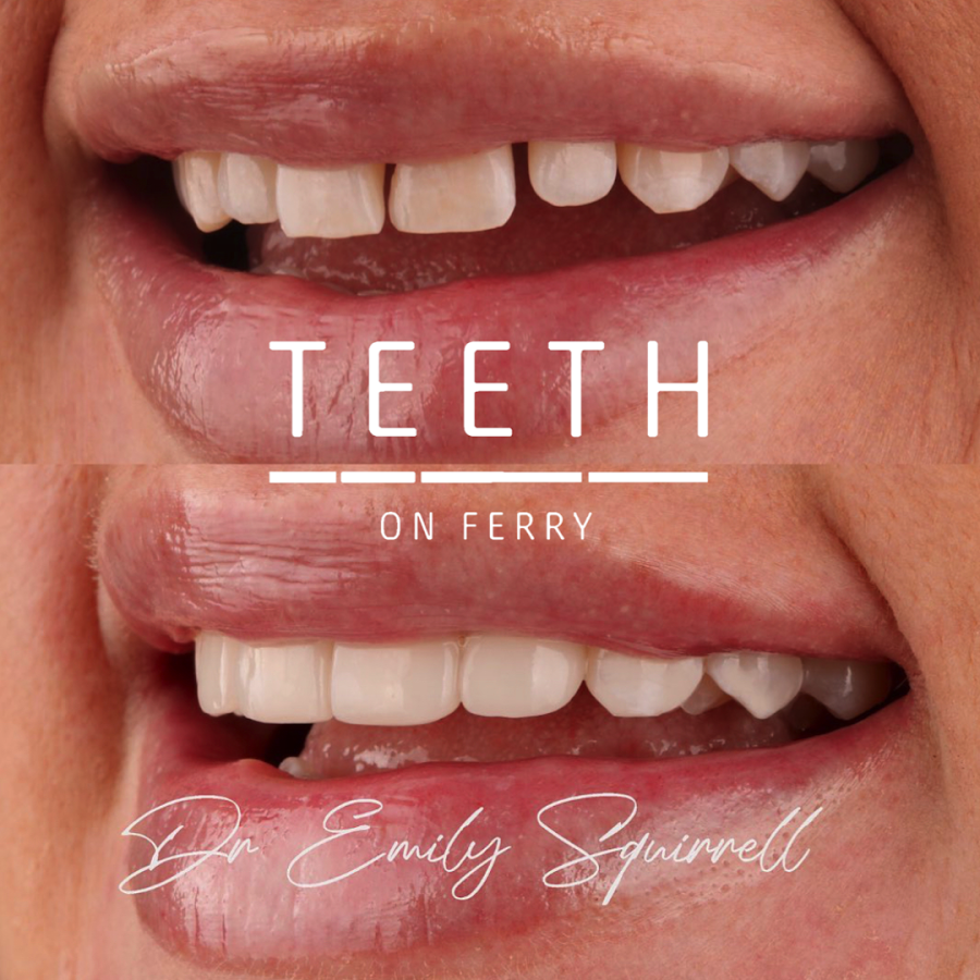 Teeth on Ferry - dental clinic in Gold Coast, Australia