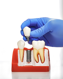 Wise Dental Gold Coast