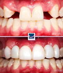 Amazing Smiles Dentist Gold Coast