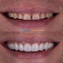 Value Dental Centres Helensvale