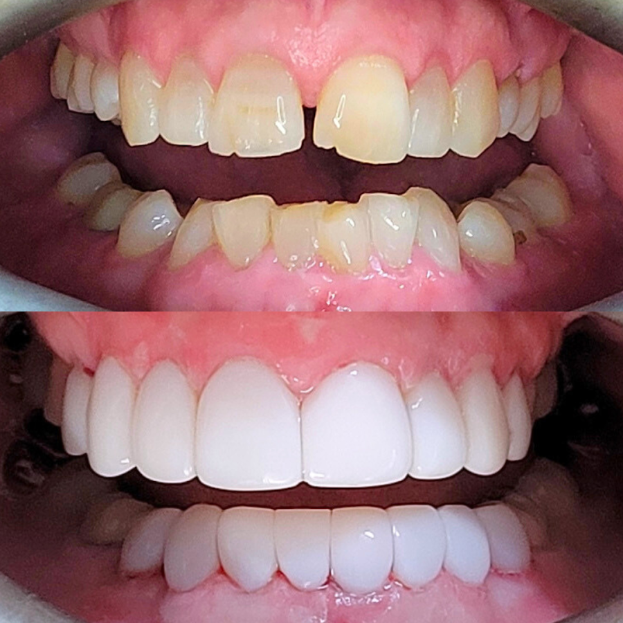 Boctor Dental SmileCentre - dental clinic in Gold Coast, Australia