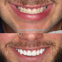 Civic Gentle Dental Care | Cosmetique Dental