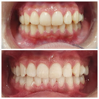 Rosedent Implant & Dental Care | Clinica dental |