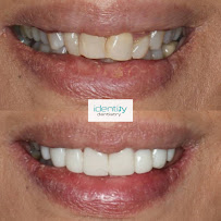 Identity Dentistry | Cosmetique Dental