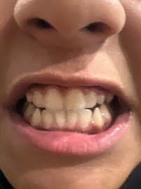 Smile Sensations Manuka