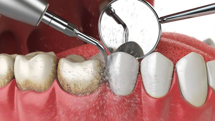 Dental Clinic Dental Protect Cancun dental clinic in Cancun