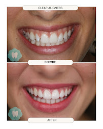 7 Pearls Dental Newcastle