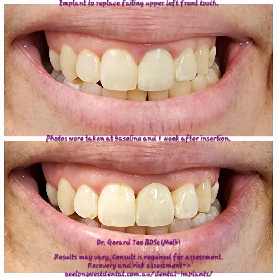 Geelong West Dental - dental clinic in Geelong, Australia