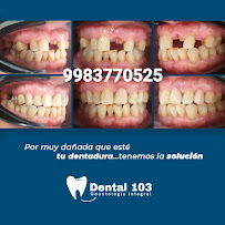 Dental 103 Odontología Integral