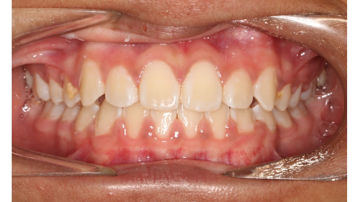 Braces N Faces Orthodontics - dental clinic in Geelong, Australia