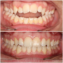 Braces N Faces Orthodontics