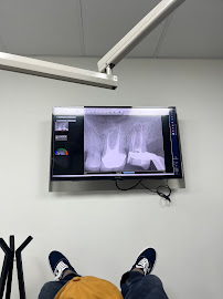 Baja Endodontics - Root Canal Endodoncia Tijuana - Dr Carlos Estrada