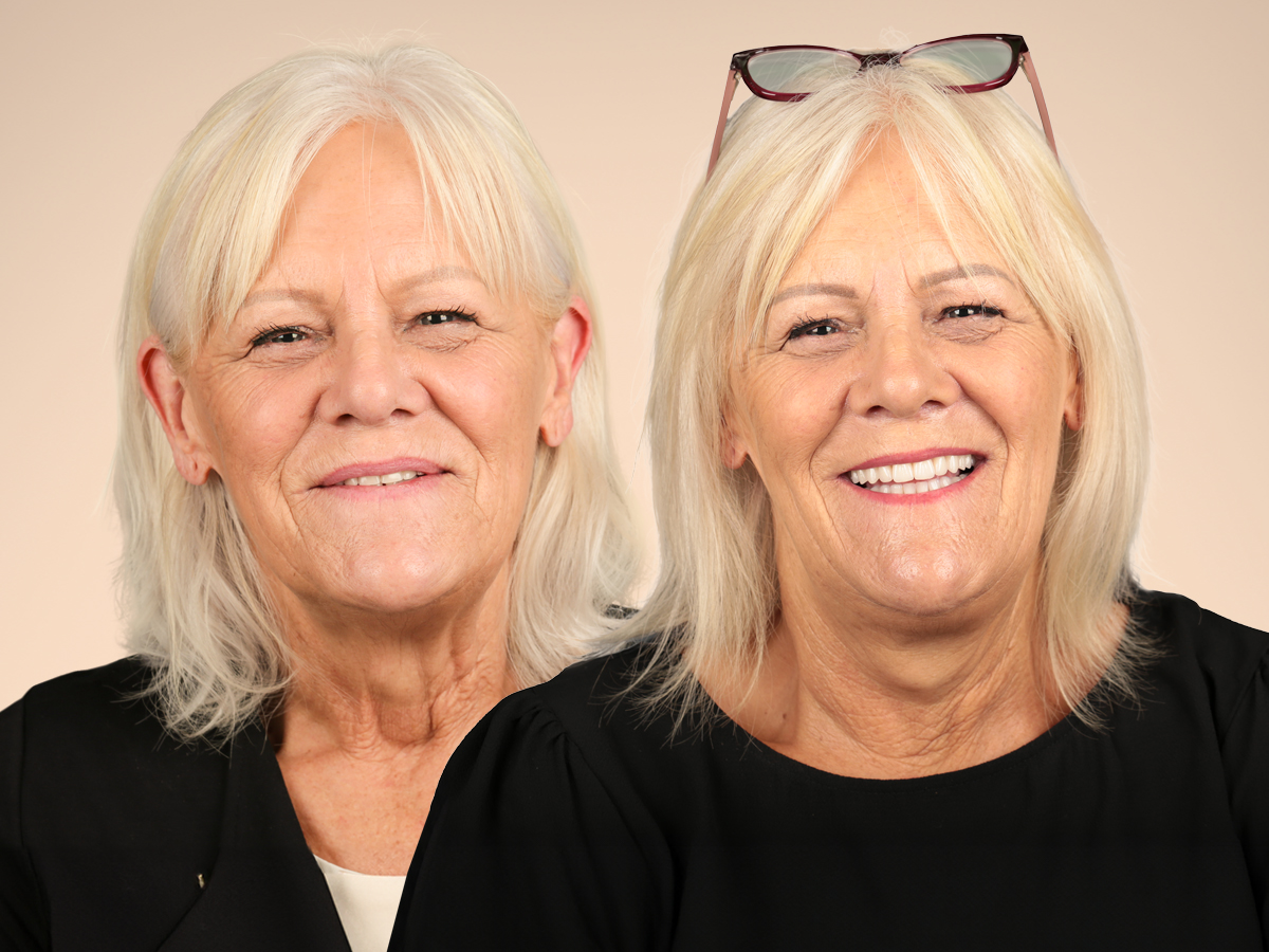 Fixed Teeth Australia Ballarat - dental clinic in Ballarat, Australia