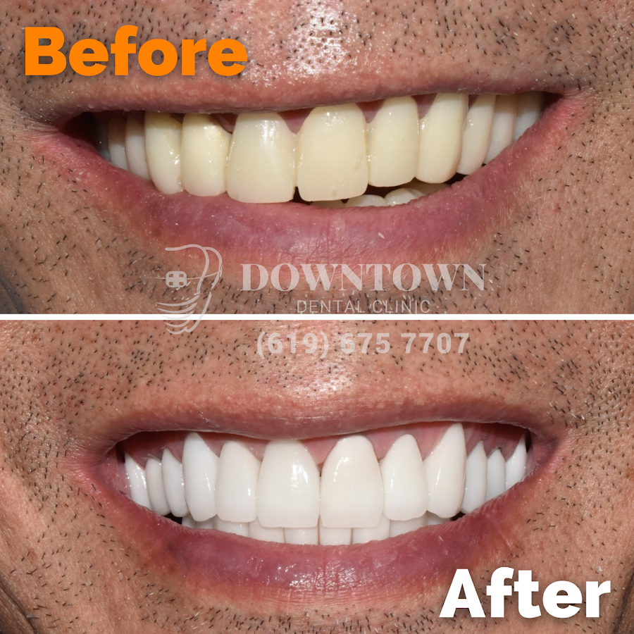 Downtown Dental Clinic - dental clinic in Tijuana