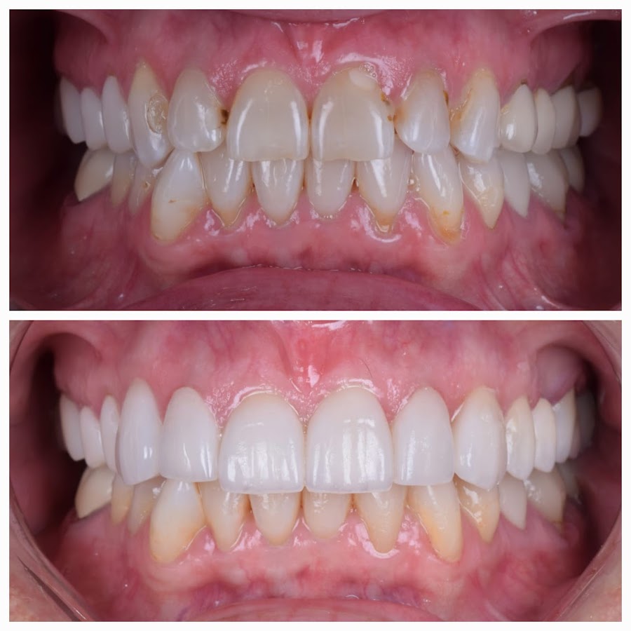 TJ Endodontics - dental clinic in Tijuana, Mexico