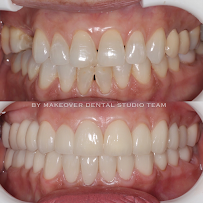 Makeover Dental Studio Tijuana