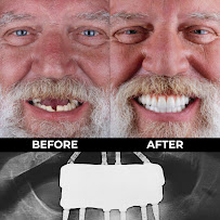 Dental Clinic Tijuana