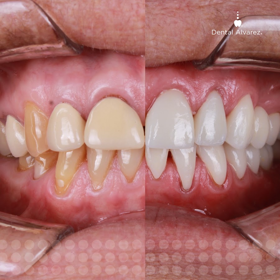 Dental Alvarez - dental clinic in Tijuana