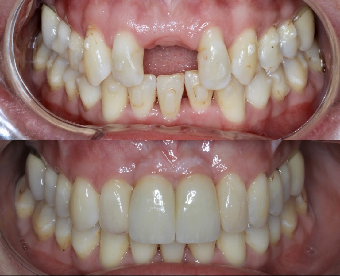 Dental Centre Maroochydore - dental clinic in Sunshine Coast, Australia