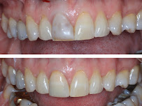 Dental Centre Maroochydore