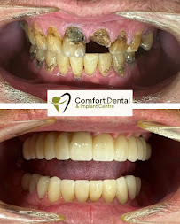 Comfort Dental & Implant Centre Buderim