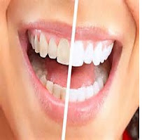 All Smiles Family Dentistry Sippy Downs