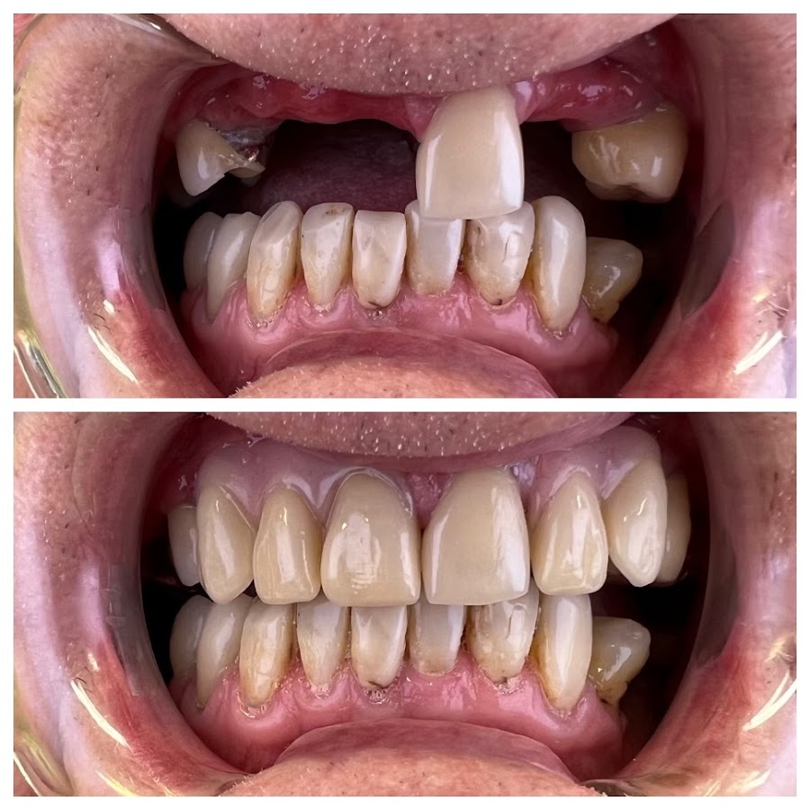 All Smiles Denture Clinic - dental clinic in Sunshine Coast, Australia