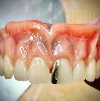 The Denture Kitchen