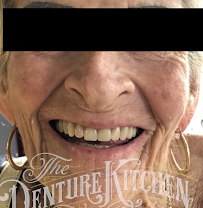 The Denture Kitchen