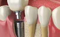 Bli Bli Dental