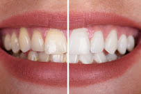 Wide Bay Central Dental