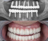 Tijuana Clinic for Cosmetic Dentistry